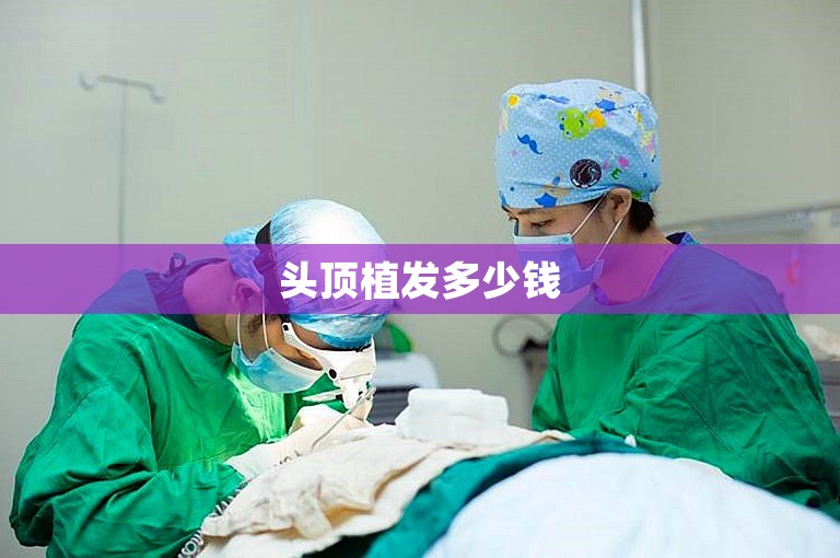头顶植发多少钱