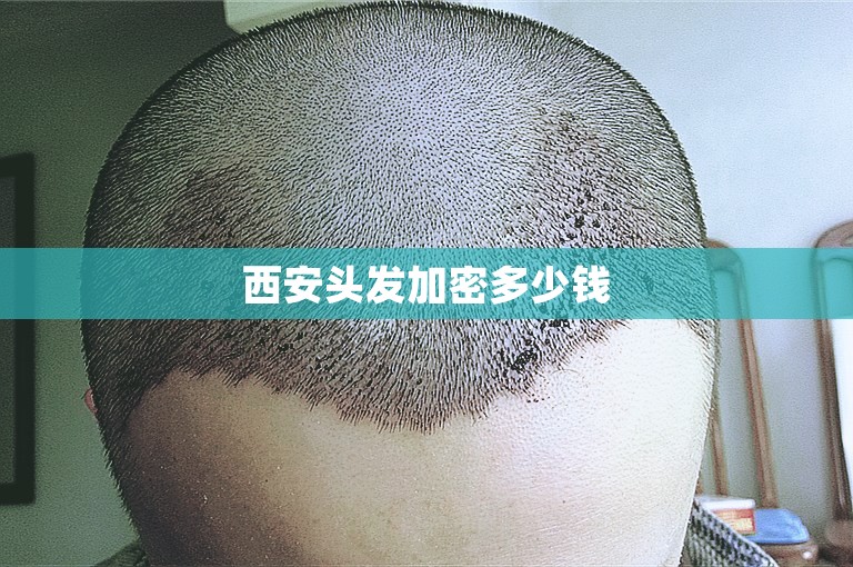 西安头发加密多少钱
