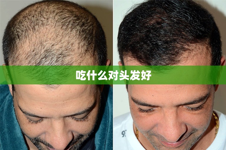 吃什么对头发好
