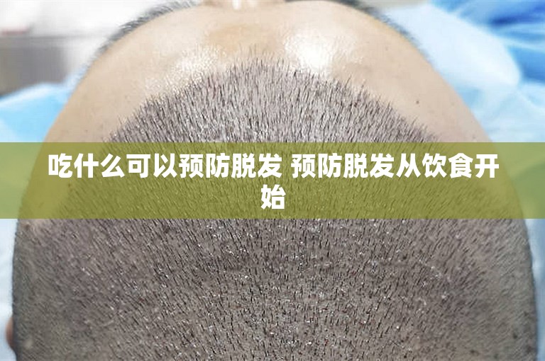 吃什么可以预防脱发 预防脱发从饮食开始