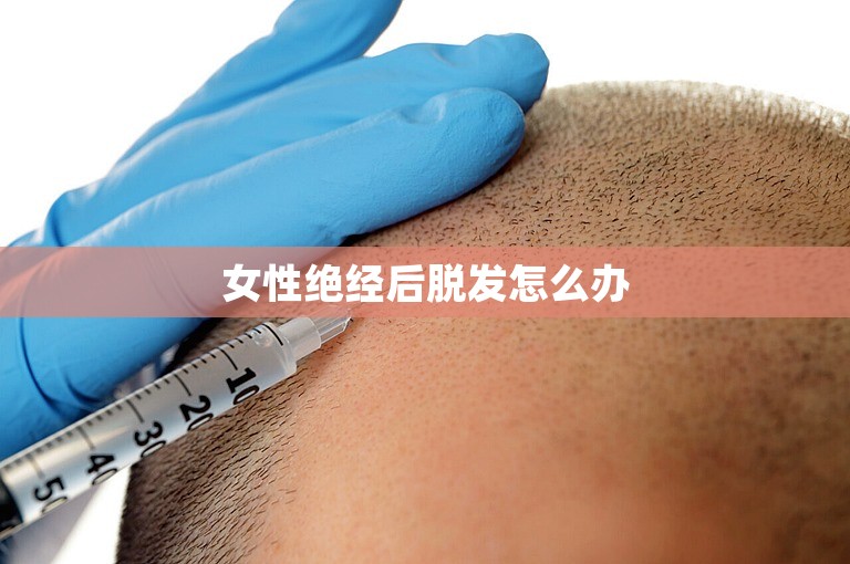 女性绝经后脱发怎么办