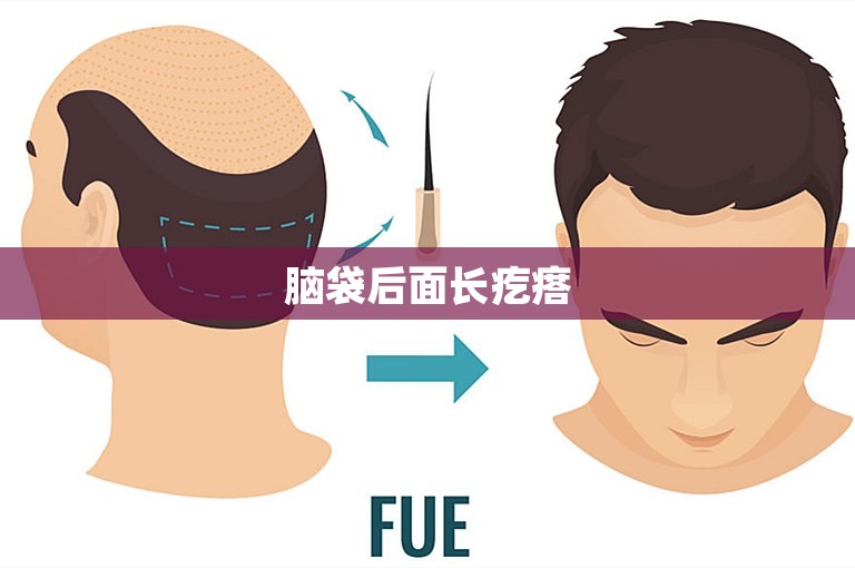 脑袋后面长疙瘩