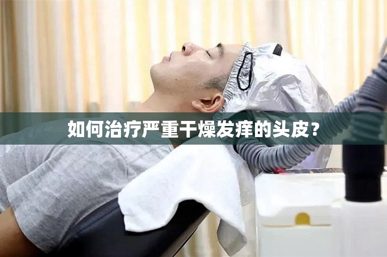 如何治疗严重干燥发痒的头皮？
