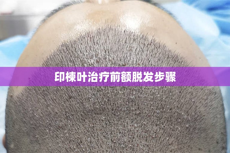 印楝叶治疗前额脱发步骤