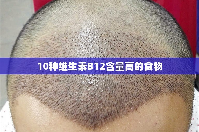 10种维生素B12含量高的食物