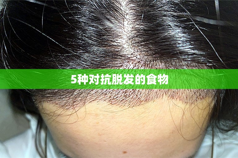 5种对抗脱发的食物 5种对抗脱发的食物