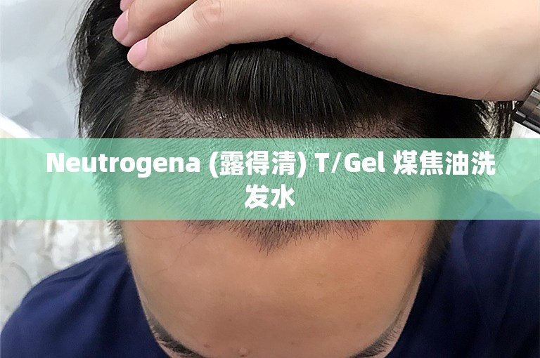 Neutrogena (露得清) T/Gel 煤焦油洗发水