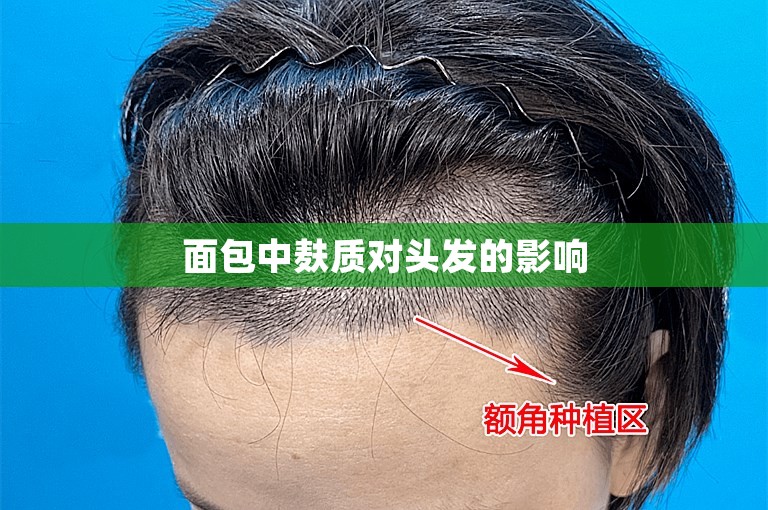 面包中麸质对头发的影响 面包中麸质对头发的影响
