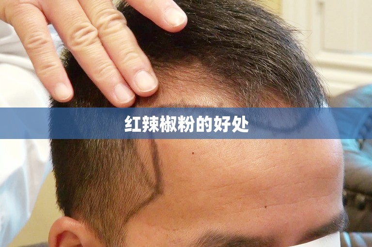 红辣椒粉的好处
