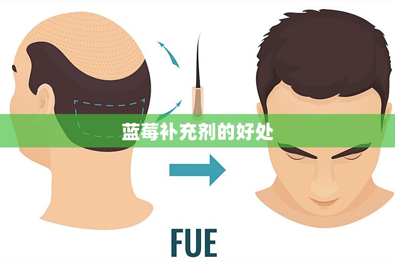 蓝莓补充剂的好处