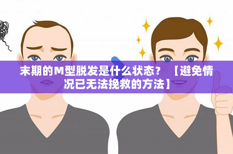 末期的Ｍ型脱发是什么状态？ 【避免情况已无法挽救的方法】