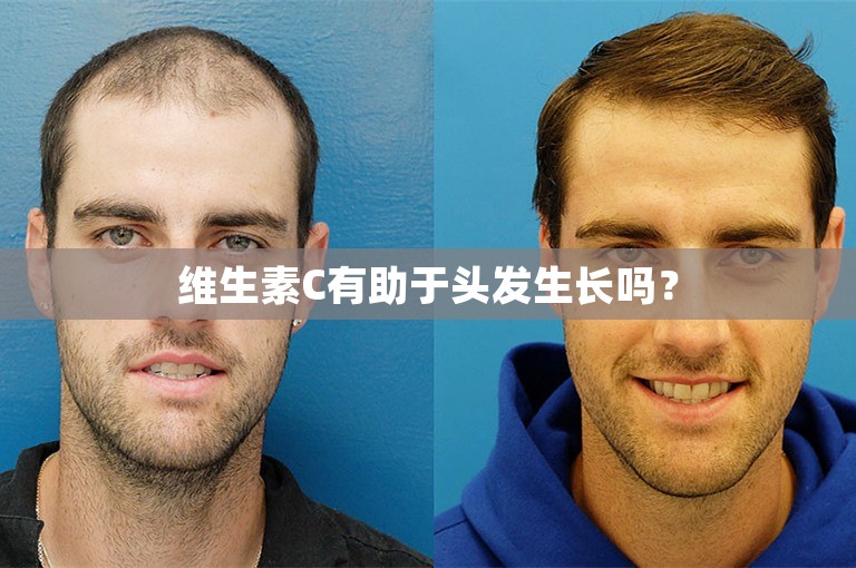 维生素C有助于头发生长吗? 维生素C有助于头发生长吗?