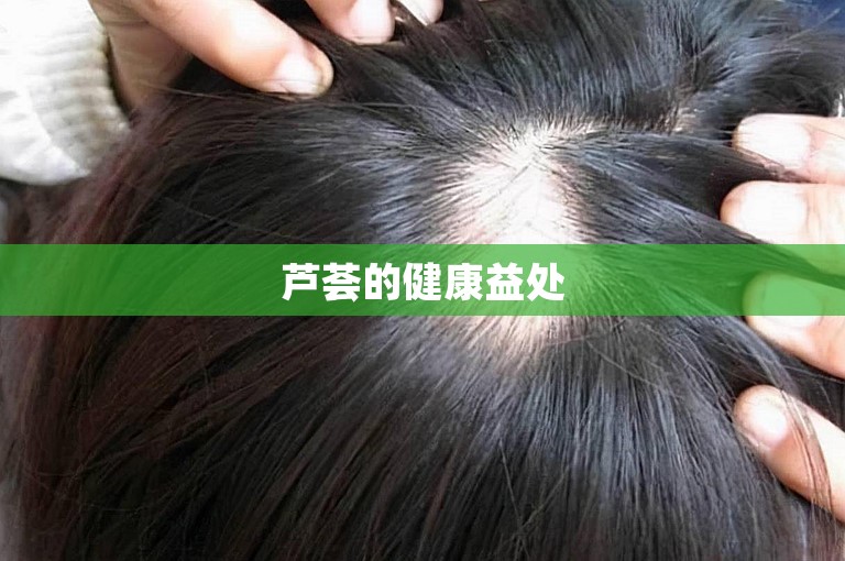 芦荟的健康益处