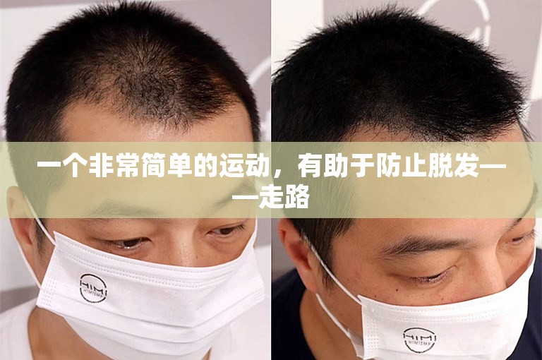 一个非常简单的运动，有助于防止脱发——走路