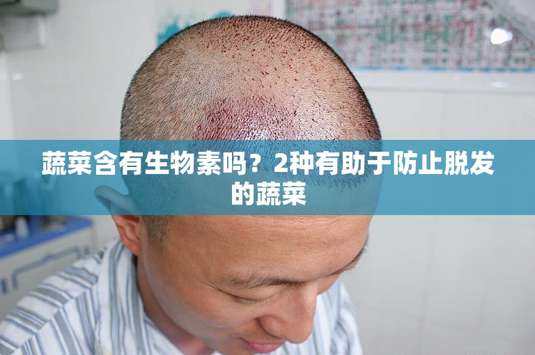 蔬菜含有生物素吗？2种有助于防止脱发的蔬菜