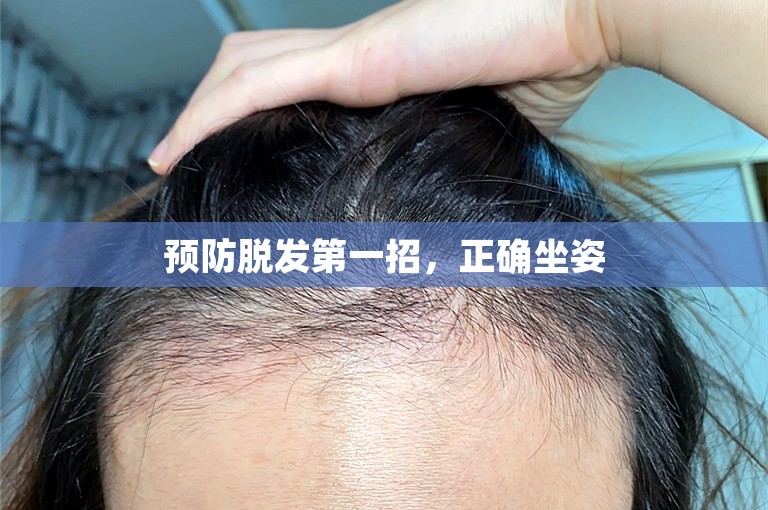 预防脱发第一招，正确坐姿