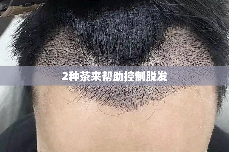 2种茶来帮助控制脱发
