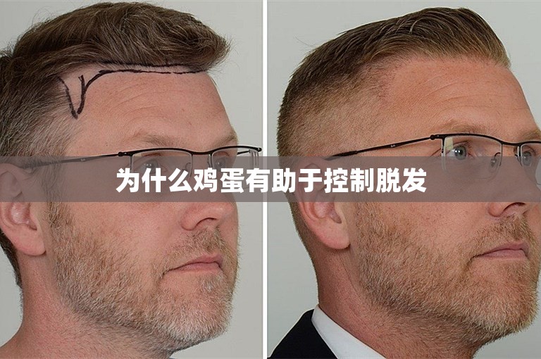 为什么鸡蛋有助于控制脱发 为什么鸡蛋有助于控制脱发