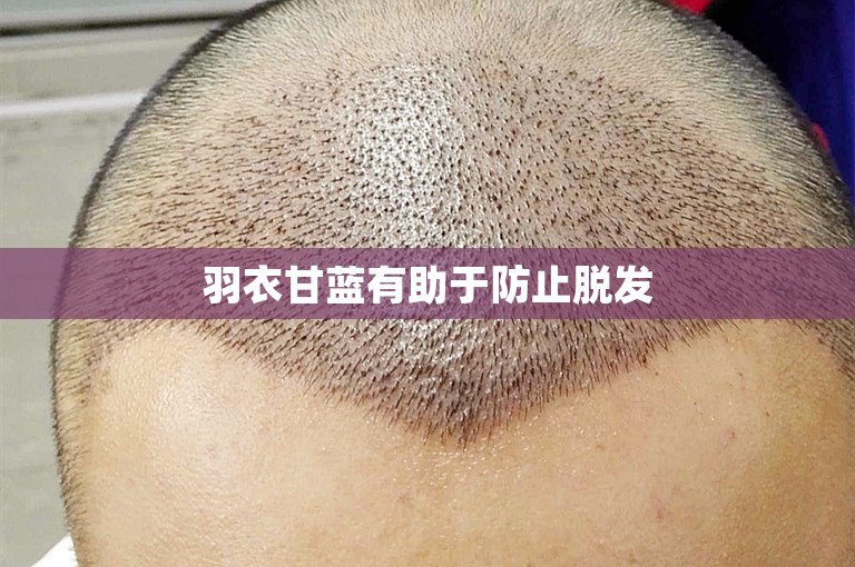 羽衣甘蓝有助于防止脱发