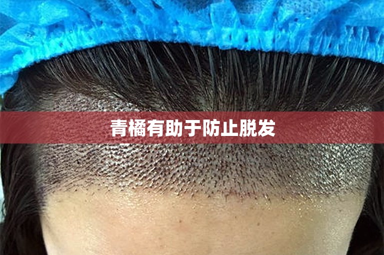 青橘有助于防止脱发