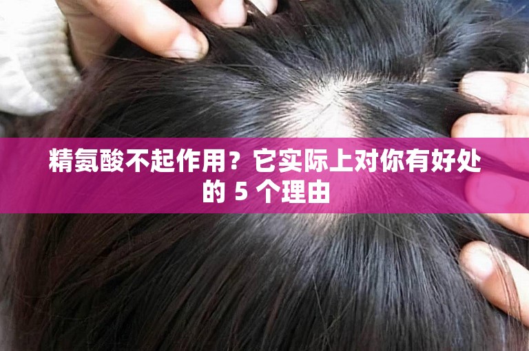 精氨酸不起作用？它实际上对你有好处的 5 个理由
