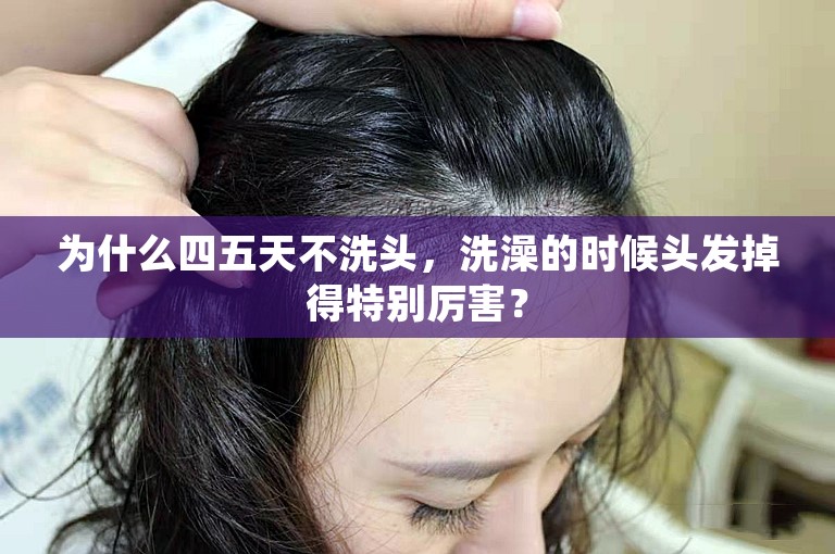 为什么四五天不洗头，洗澡的时候头发掉得特别厉害？
