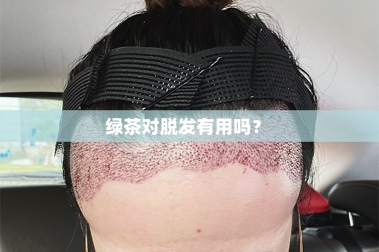 绿茶对脱发有用吗？ 