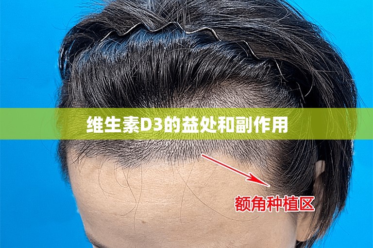 维生素D3的益处和副作用