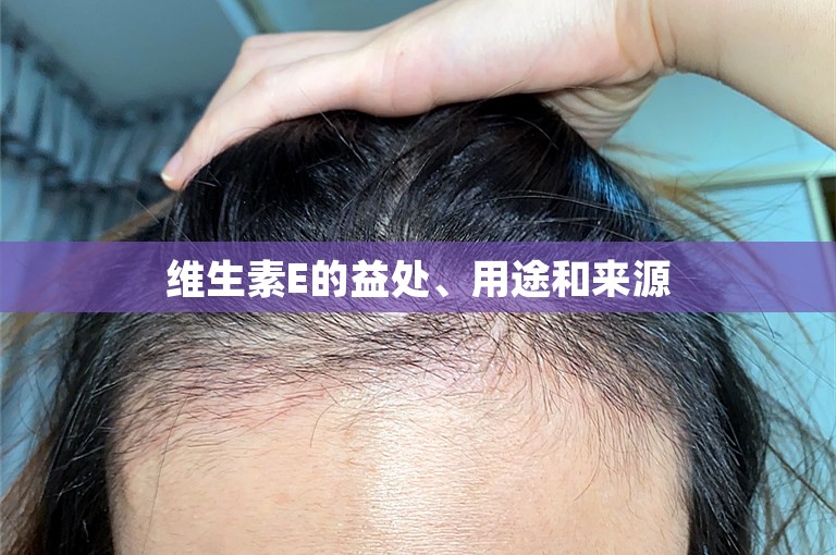 维生素E的益处、用途和来源