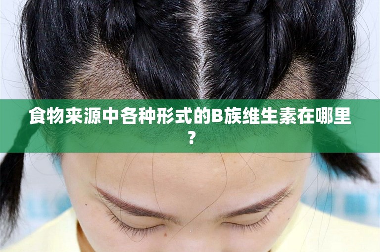 食物来源中各种形式的B族维生素在哪里？