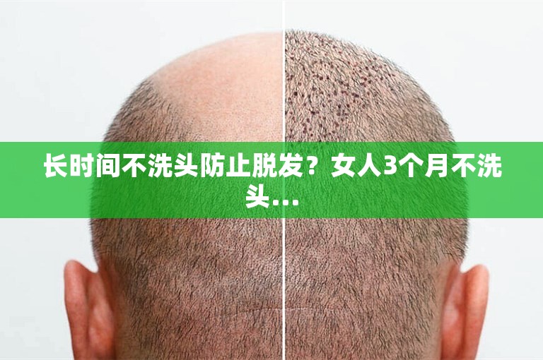 长时间不洗头防止脱发?女人3个月不洗头... 长时间不洗头防止脱发?女人3个月不洗头...