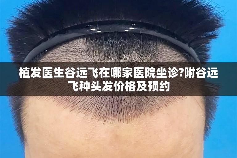 植发医生谷远飞在哪家医院坐诊?附谷远飞种头发价格及预约