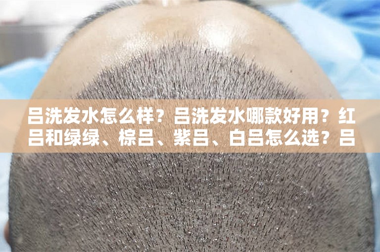吕洗发水怎么样？吕洗发水哪款好用？红吕和绿绿、棕吕、紫吕、白吕怎么选？吕洗发水哪款防脱发？