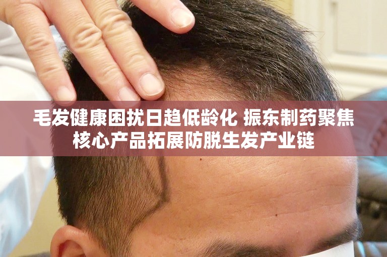 毛发健康困扰日趋低龄化 振东制药聚焦核心产品拓展防脱生发产业链
