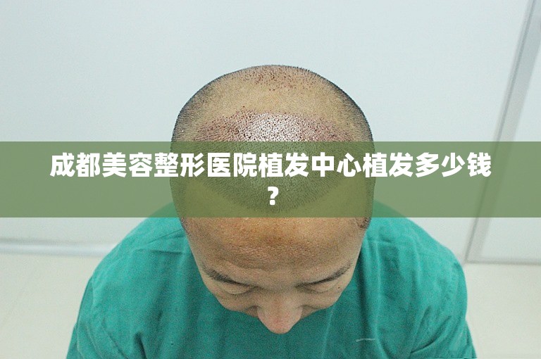 成都美容整形医院植发中心植发多少钱？