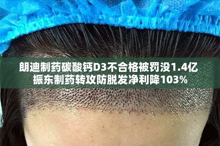 朗迪制药碳酸钙D3不合格被罚没1.4亿 振东制药转攻防脱发净利降103%