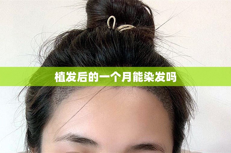 植发后的一个月能染发吗