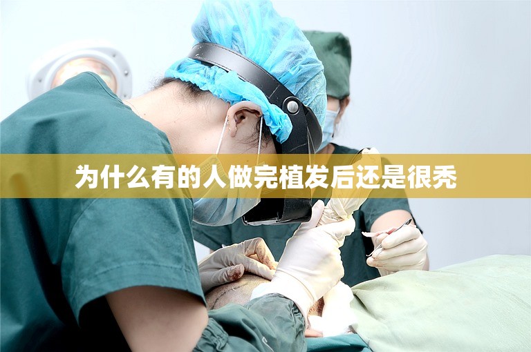 为什么有的人做完植发后还是很秃