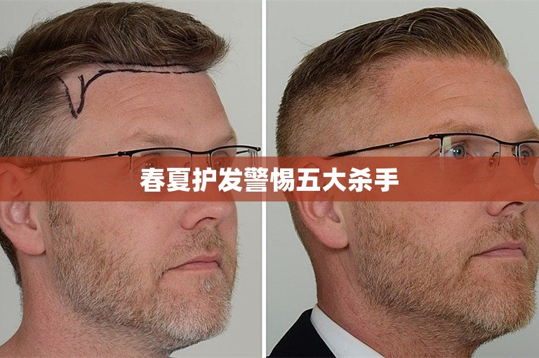 春夏护发警惕五大杀手
