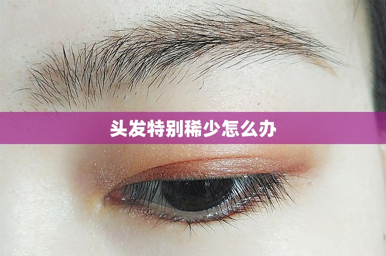 头发特别稀少怎么办