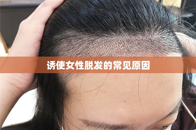 诱使女性脱发的常见原因