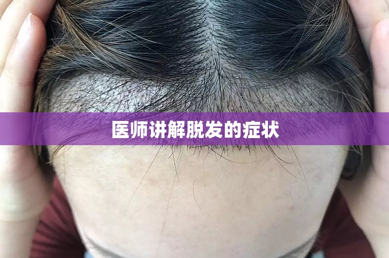 医师讲解脱发的症状