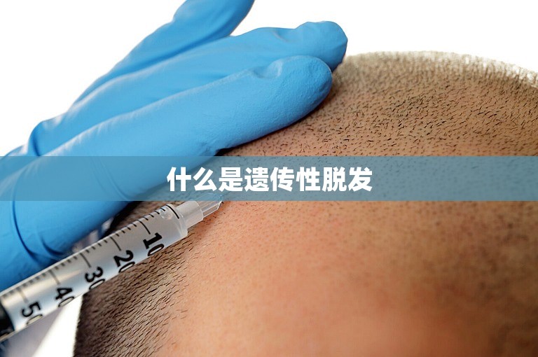 什么是遗传性脱发