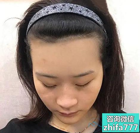 天津大麦美人尖种植效果特别好