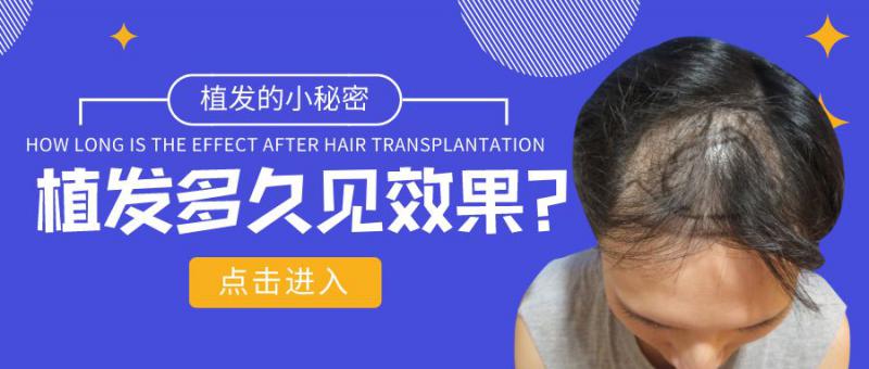 年前植发的人现在头发都长成什么样了？